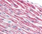 TUBB / Beta Tubulin Antibody (clone TU-06)